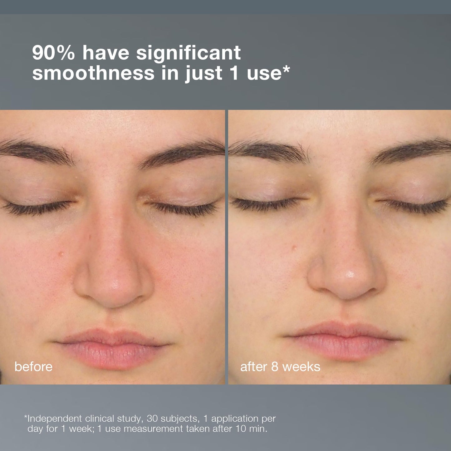 Dermalogica Daily Milkfoliant Exfoliating Powder Cleanser for Sensitive Skin - Gentle, Natural, and Effective Daily Skincare