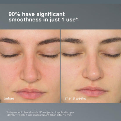 Dermalogica Daily Milkfoliant Exfoliating Powder Cleanser for Sensitive Skin - Gentle, Natural, and Effective Daily Skincare